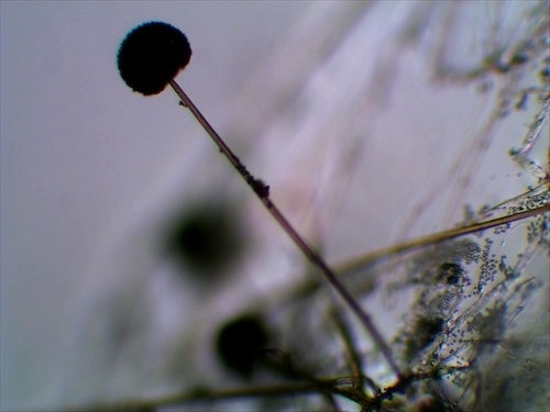 A picture of black mold (rhizopus sp) spores using Light Microscope shows a dark flowerlike ovoid on a long stem